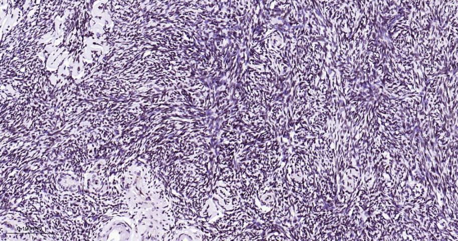 热休克因子1重组兔单抗