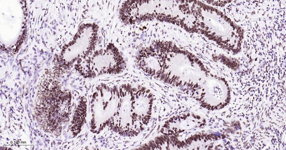 热休克因子1重组兔单抗