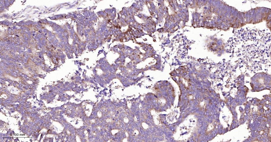信号转导和转录激活因子6重组兔单抗