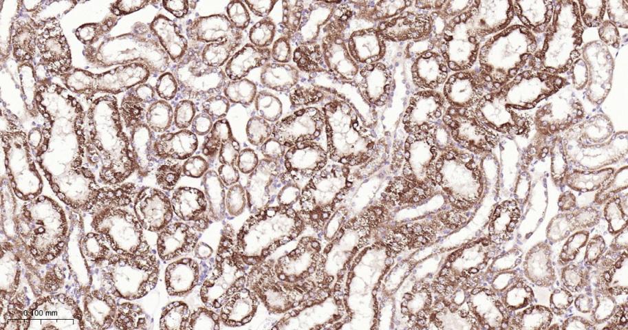 信号转导和转录激活因子6重组兔单抗