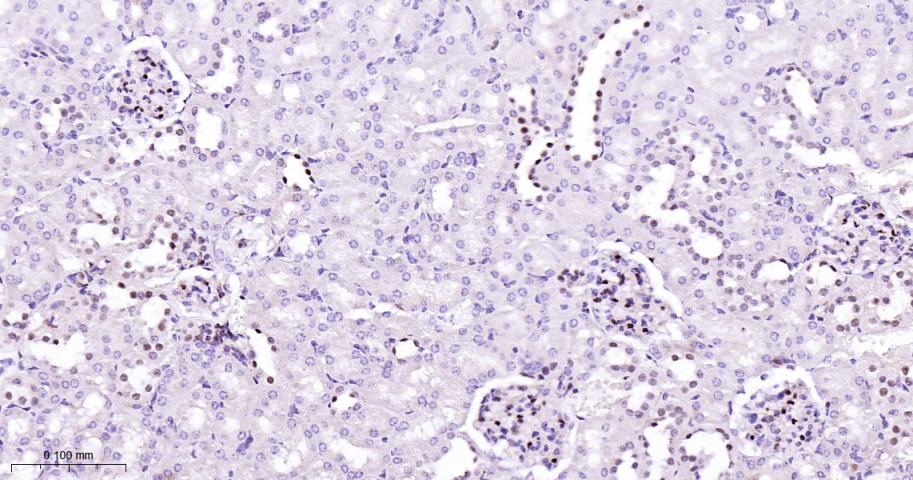 GATA结合蛋白3重组兔单克隆抗体