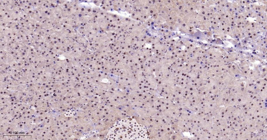 细胞核转录因子X盒结合蛋白重组兔单抗