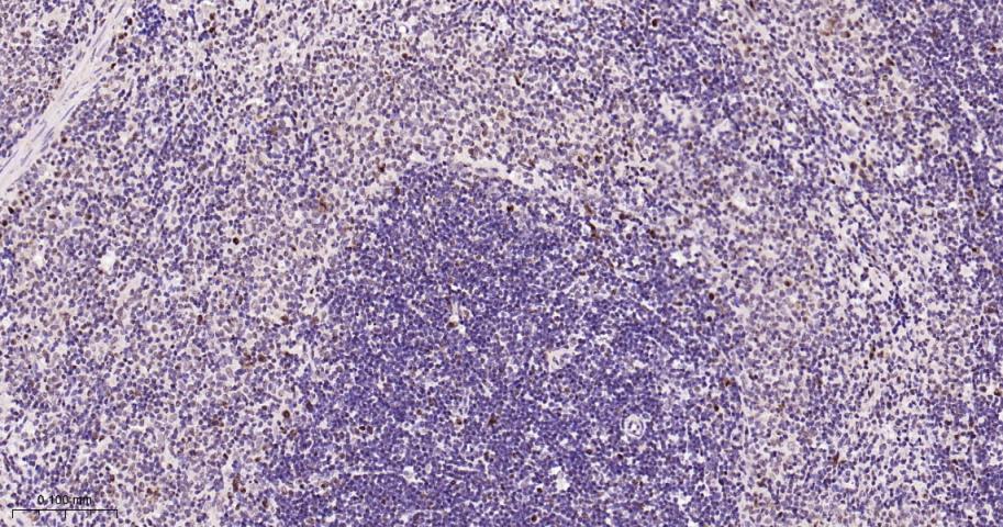 细胞核转录因子X盒结合蛋白重组兔单抗