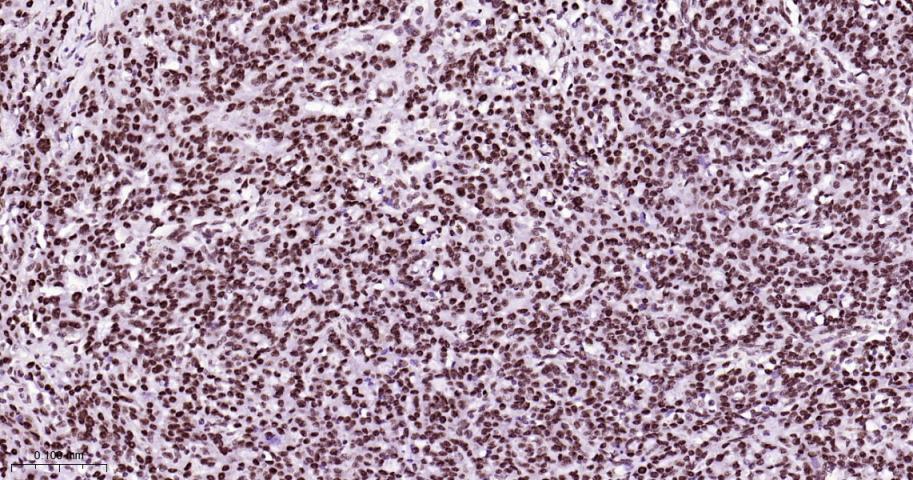 热休克因子1重组兔单抗