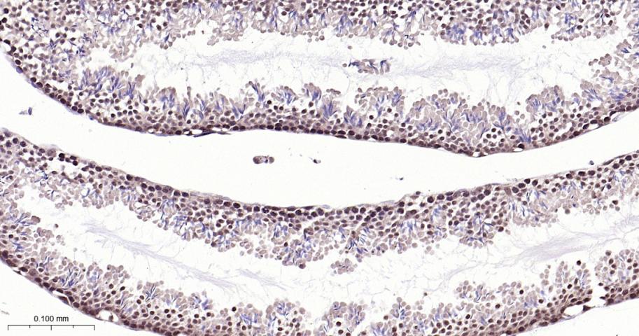 核有丝分裂器NuMA蛋白重组兔单抗
