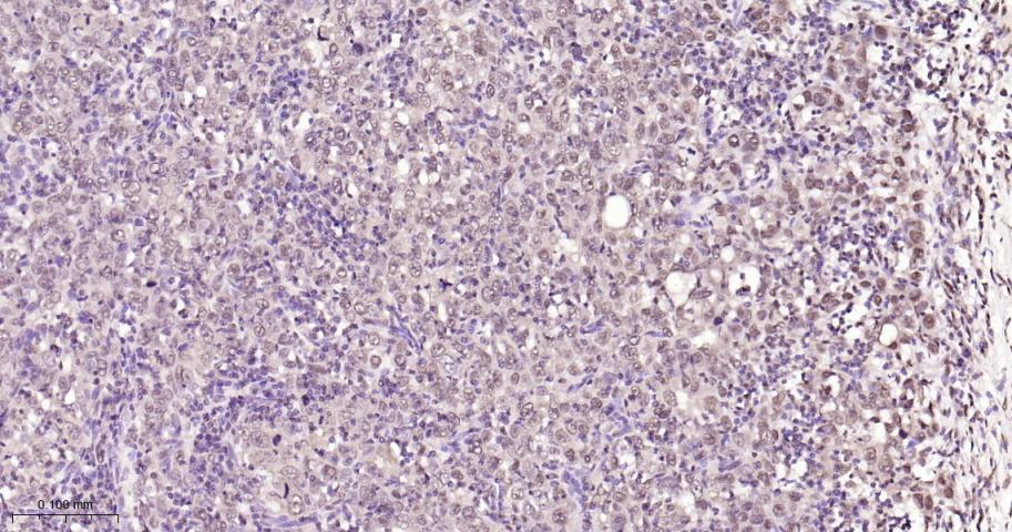 核有丝分裂器NuMA蛋白重组兔单抗