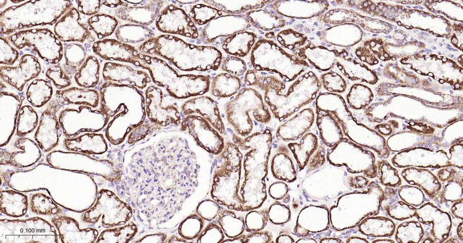 信号转导和转录激活因子6重组兔单抗