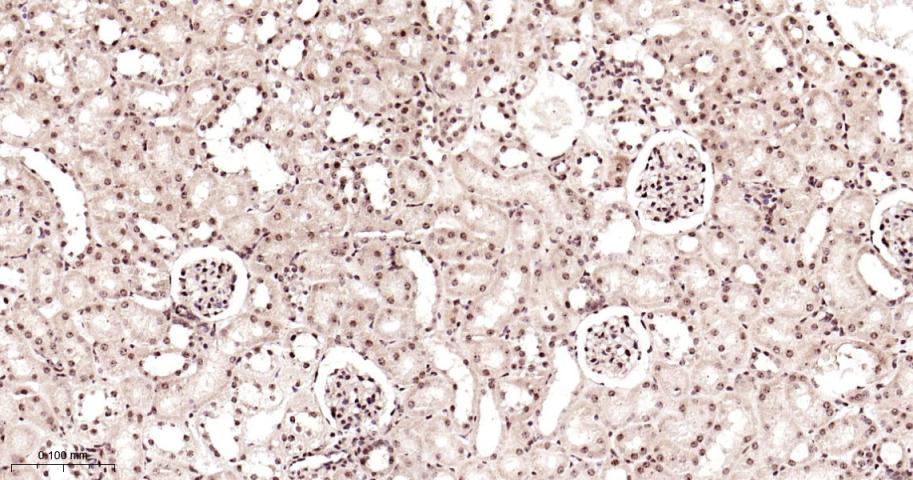 细胞核转录因子X盒结合蛋白重组兔单抗