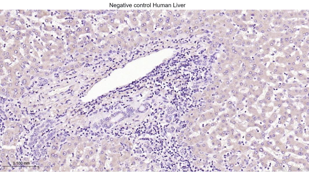 zeta相关蛋白70重组兔单抗