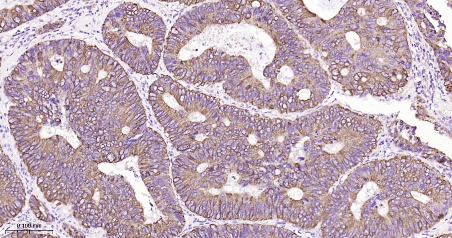 细胞角蛋白18重组兔单抗