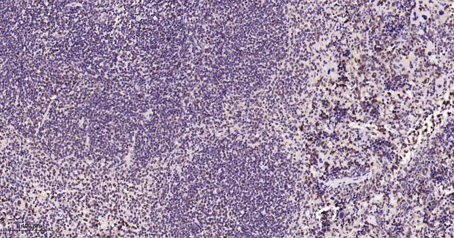 细胞核转录因子X盒结合蛋白重组兔单抗