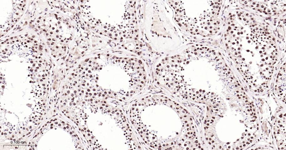 核有丝分裂器NuMA蛋白重组兔单抗