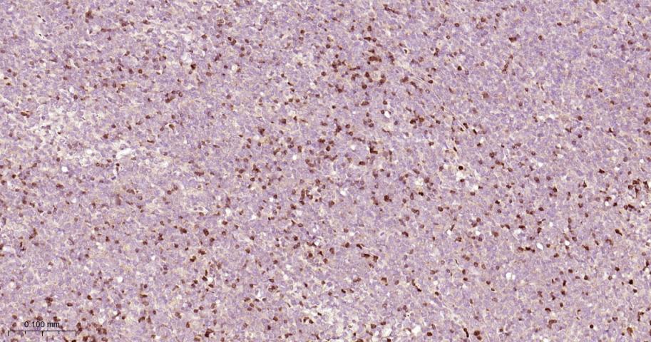 zeta相关蛋白70重组兔单抗