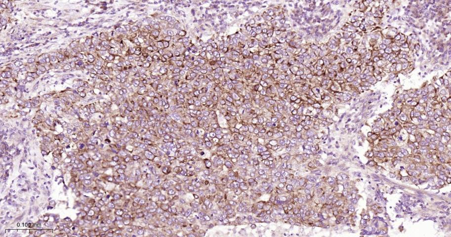 细胞角蛋白18重组兔单抗