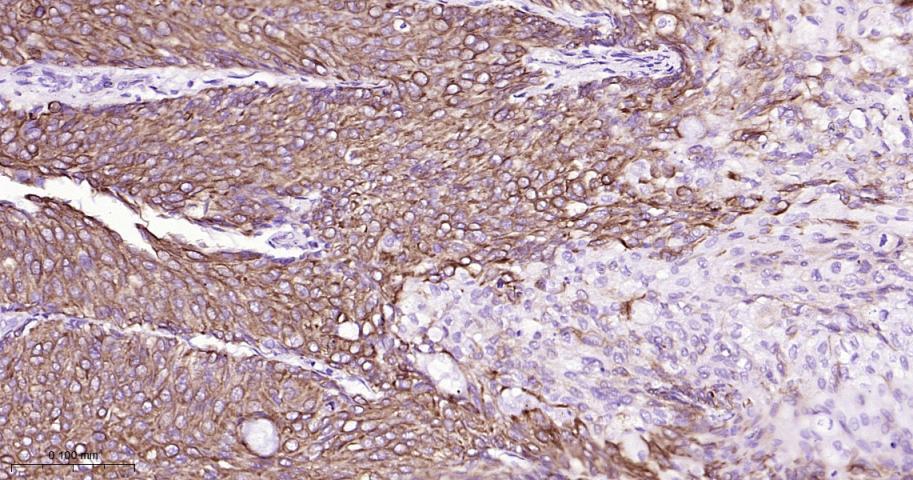 细胞角蛋白18重组兔单抗