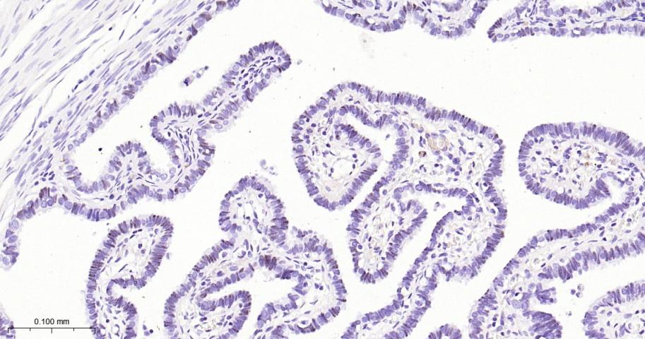 配对盒基因8重组兔单抗