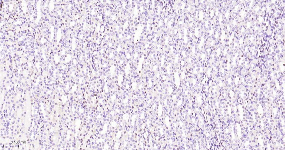 配对盒基因8重组兔单抗