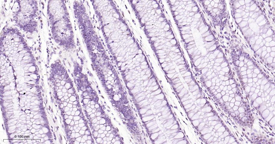 缺氧诱导因子1β/HIF-1β重组兔单抗