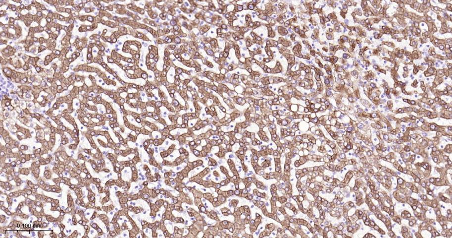 细胞角蛋白18重组兔单抗