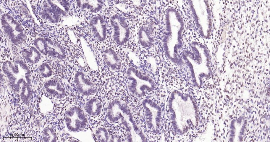 缺氧诱导因子1β/HIF-1β重组兔单抗