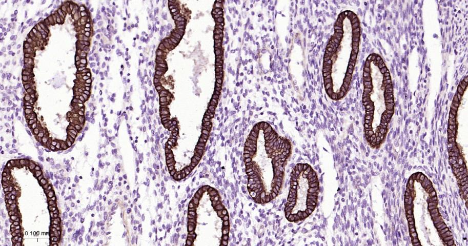 细胞角蛋白18重组兔单抗