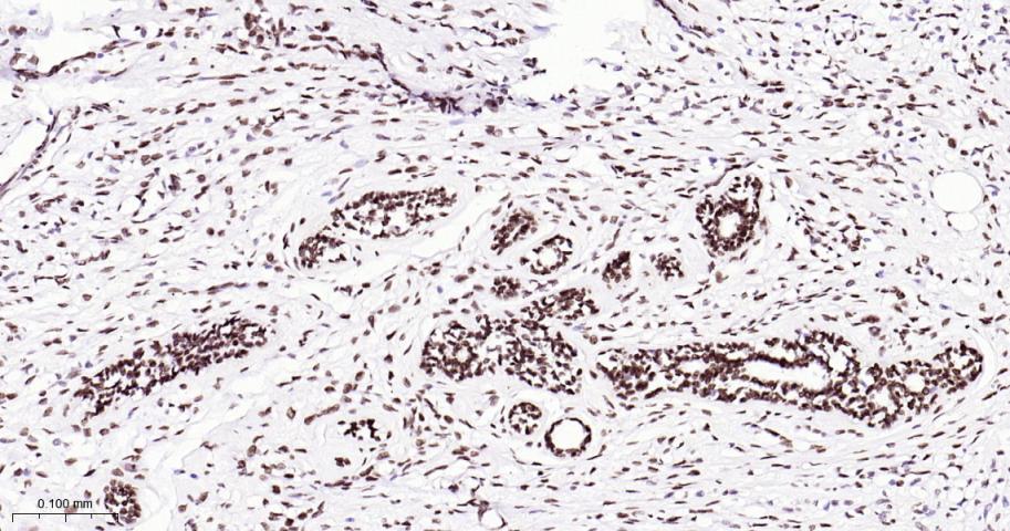 热休克因子1重组兔单抗