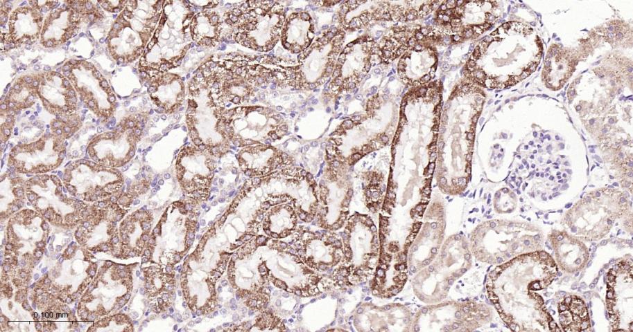 信号转导和转录激活因子6重组兔单抗