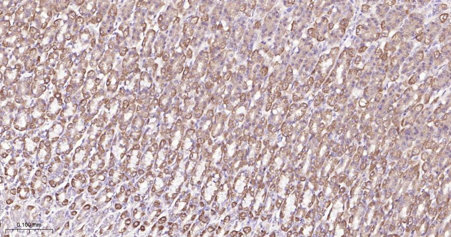 信号转导和转录激活因子6重组兔单抗