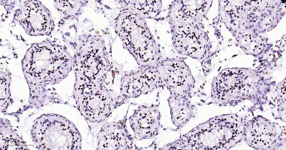 热休克因子1重组兔单抗