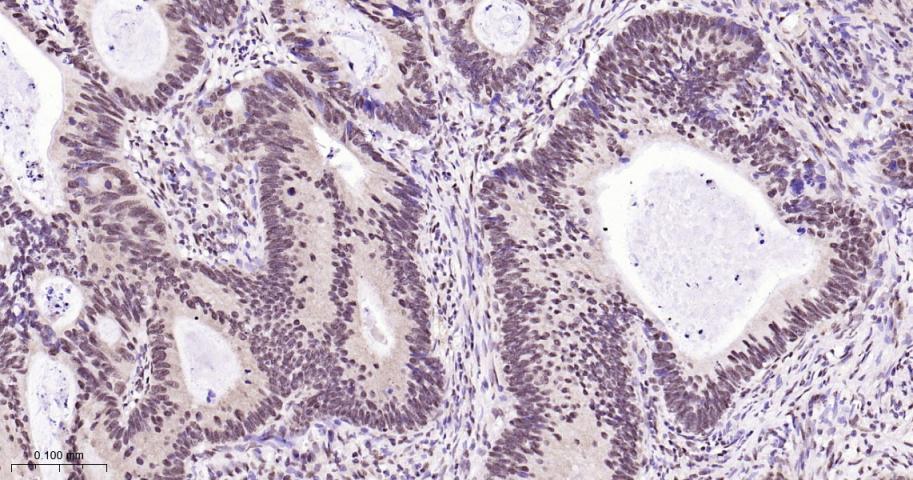 核有丝分裂器NuMA蛋白重组兔单抗