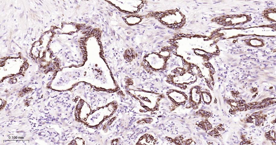 细胞角蛋白18重组兔单抗