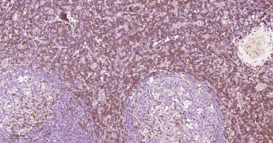 zeta相关蛋白70重组兔单抗