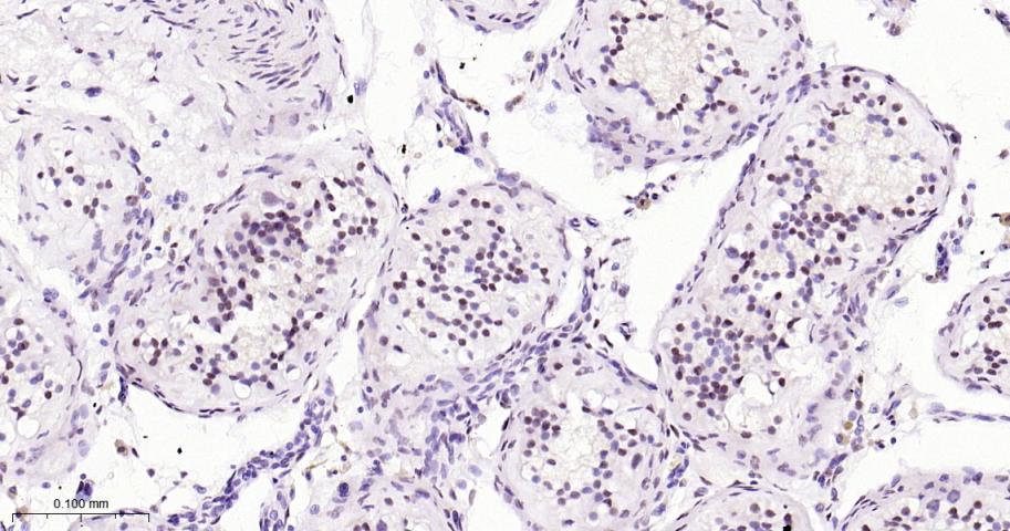 缺氧诱导因子1β/HIF-1β重组兔单抗