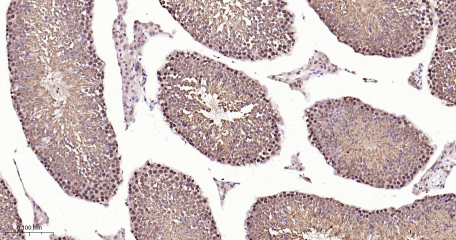 细胞核转录因子X盒结合蛋白重组兔单抗