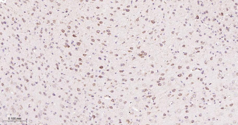 信号转导和转录激活因子6重组兔单抗