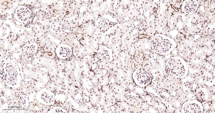 细胞核转录因子X盒结合蛋白重组兔单抗