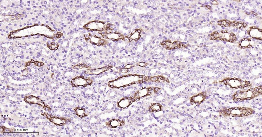 细胞角蛋白18重组兔单抗