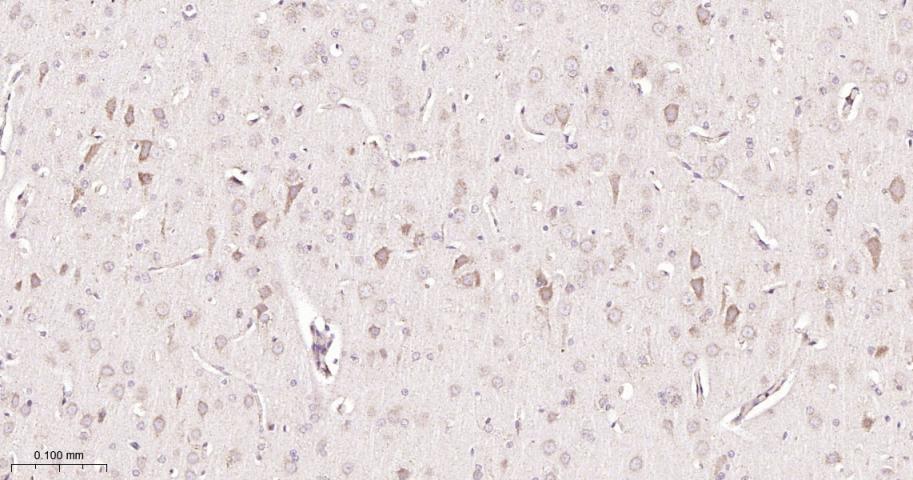 信号转导和转录激活因子6重组兔单抗