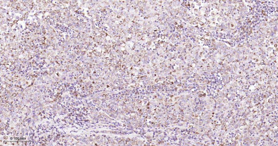 信号转导和转录激活因子6重组兔单抗