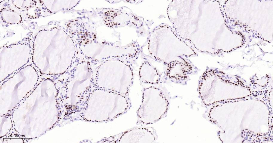 配对盒基因8重组兔单抗