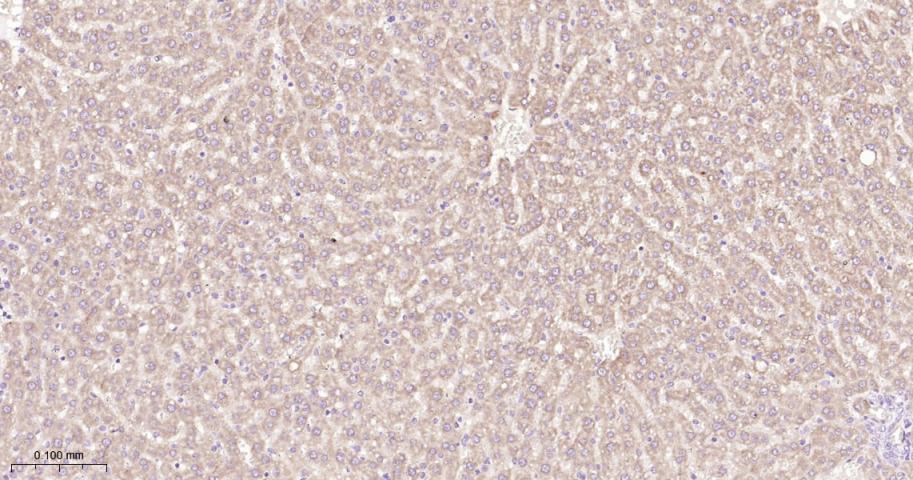信号转导和转录激活因子6重组兔单抗