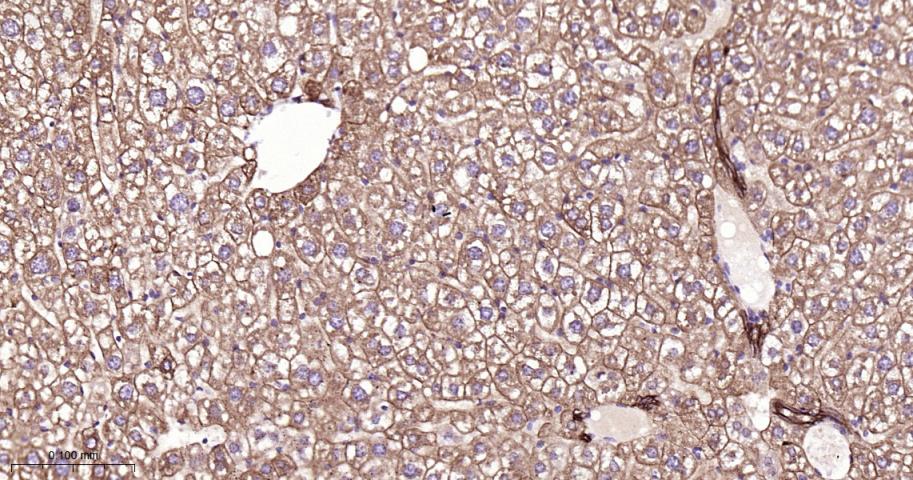 细胞角蛋白18重组兔单抗