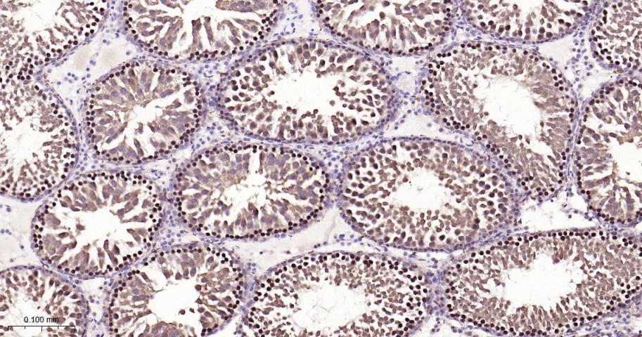 细胞核转录因子X盒结合蛋白重组兔单抗