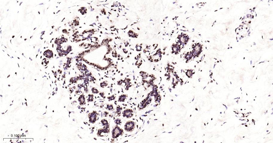 核有丝分裂器NuMA蛋白重组兔单抗