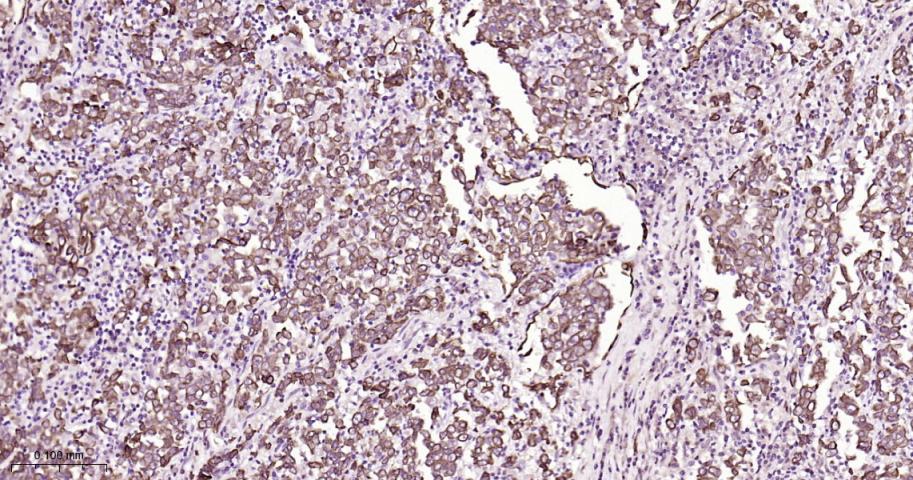 细胞角蛋白18重组兔单抗