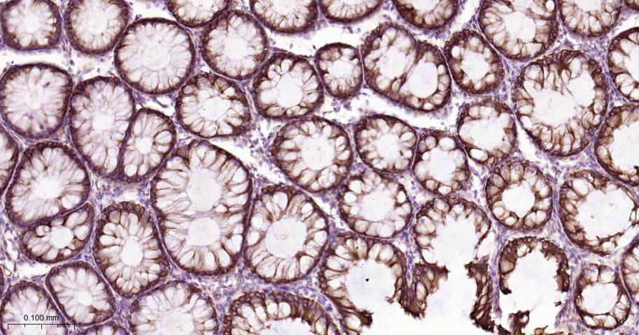 细胞角蛋白18重组兔单抗