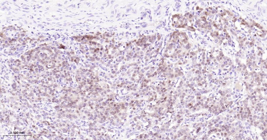 配对盒基因8重组兔单抗