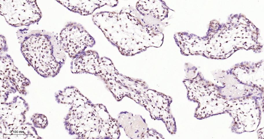缺氧诱导因子1β/HIF-1β重组兔单抗