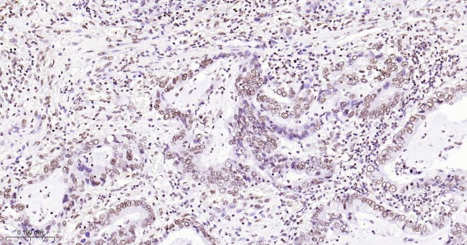 热休克因子1重组兔单抗