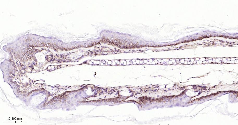 整合素β1（CD29）重组兔单抗